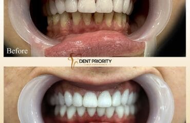 dent-priority-11