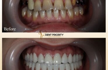 dent-priority-16