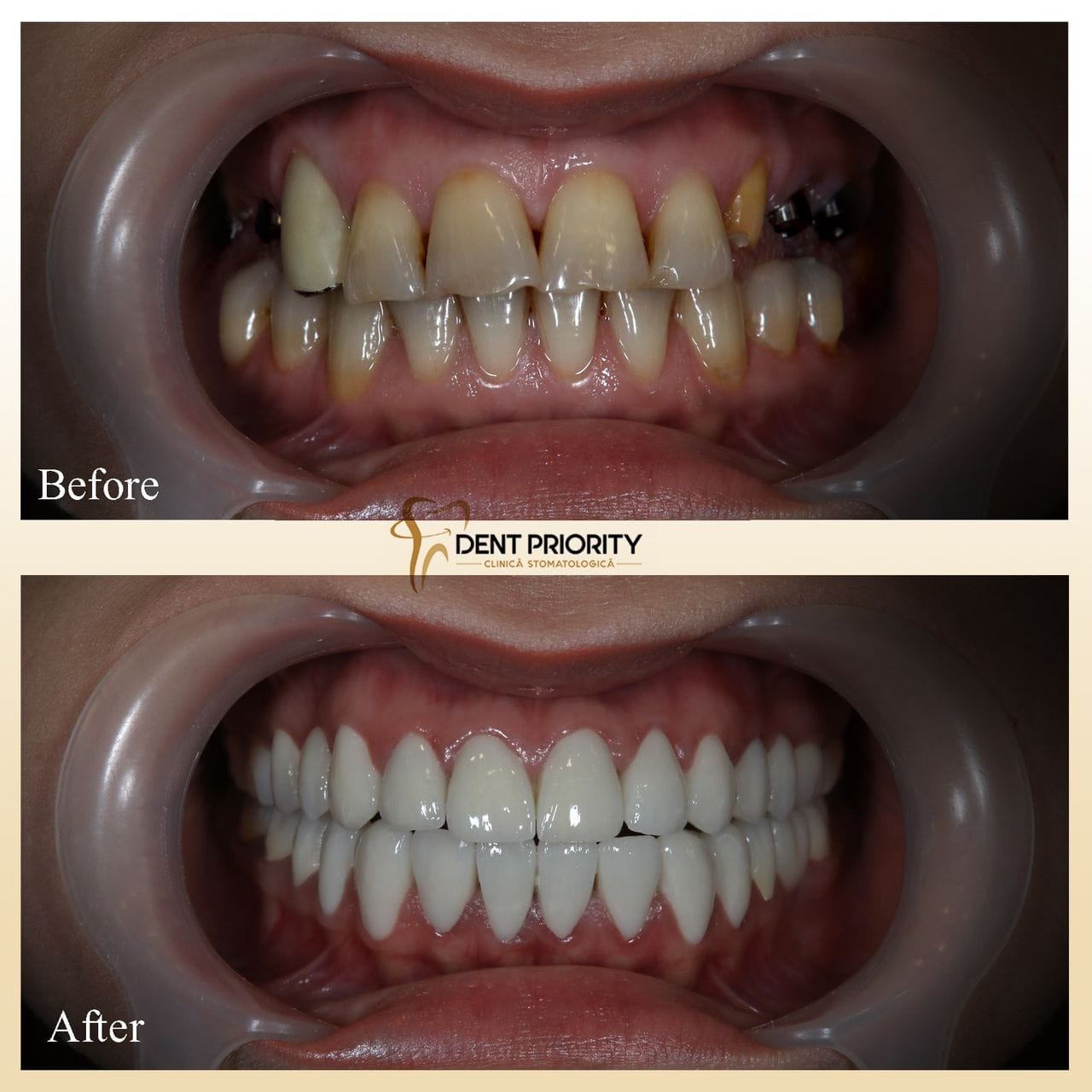 dent-priority-16