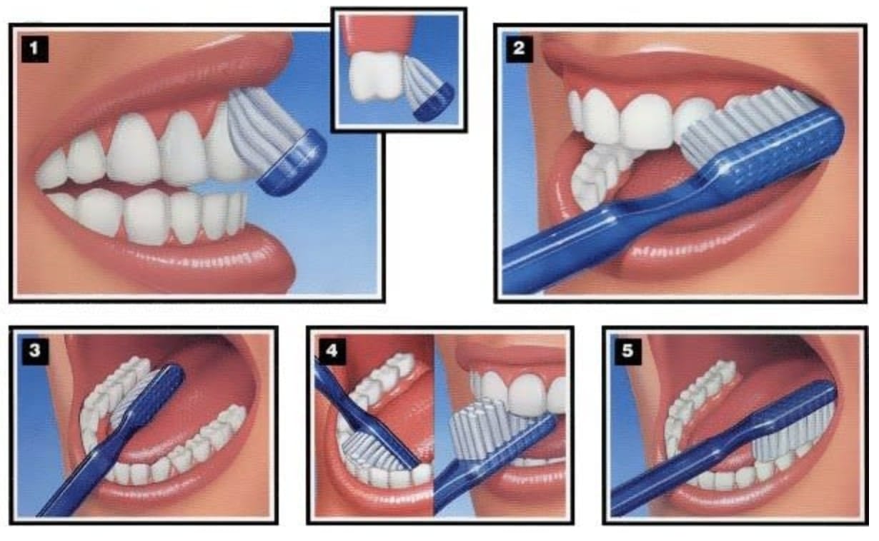 tehnici-de-periaj-dentpriority