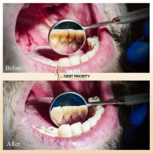 Avantajele detartrajului periodic