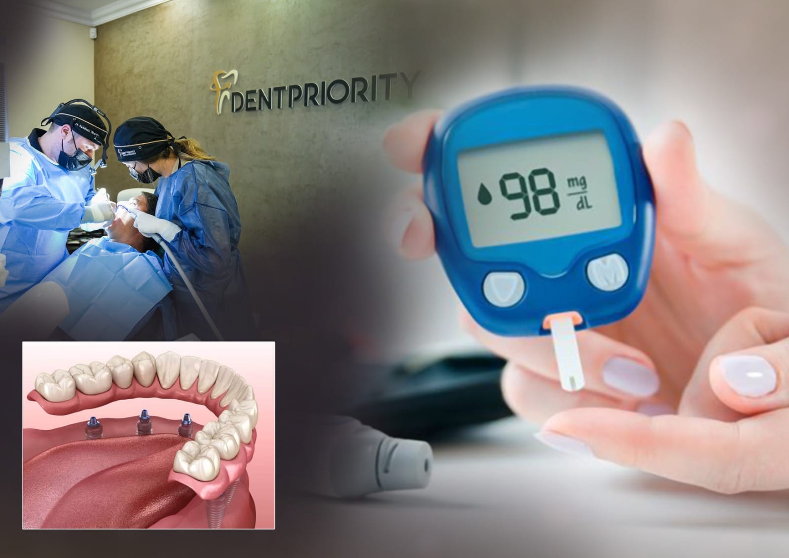 implant dentar