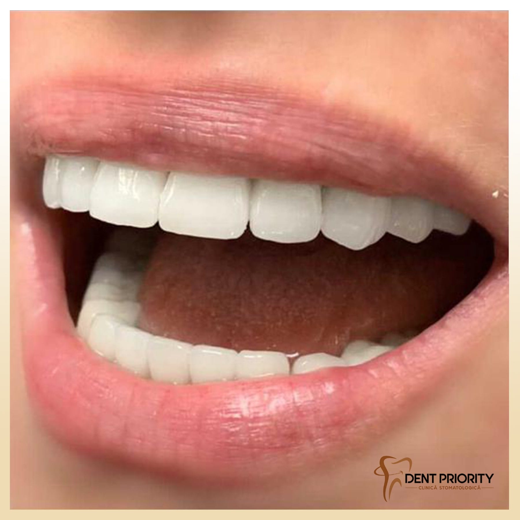 dent-priority-10