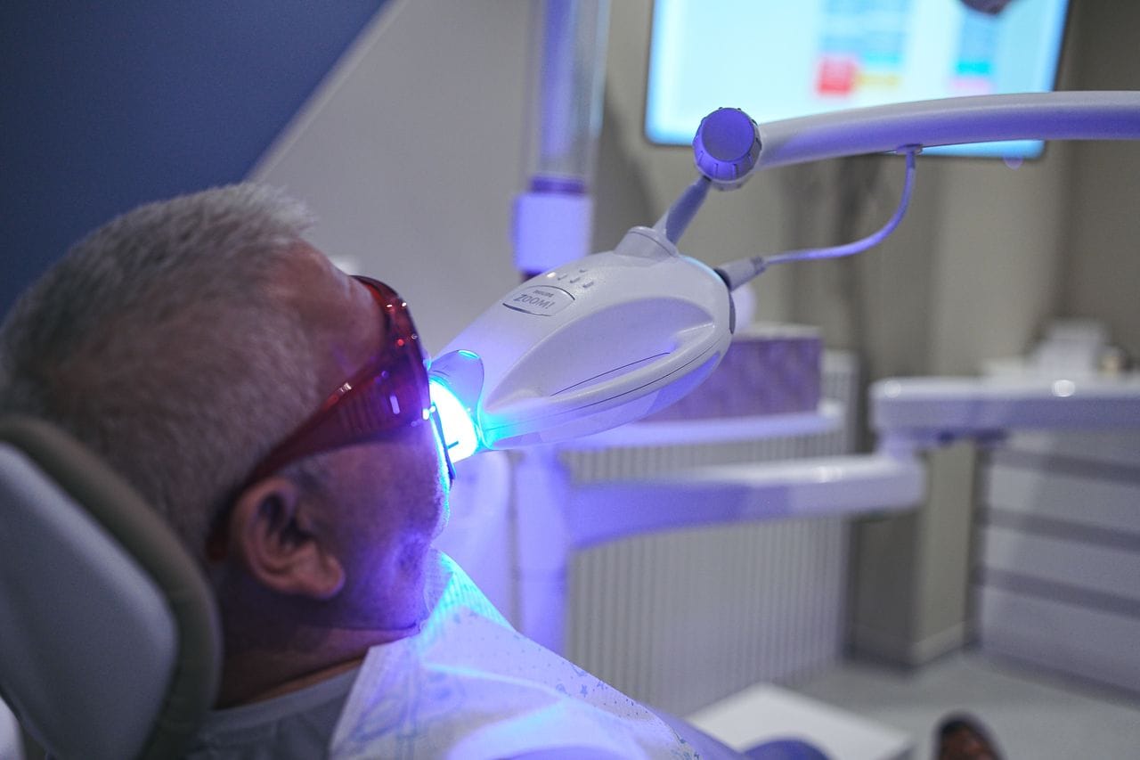 Cât de des este recomandată albirea dentară